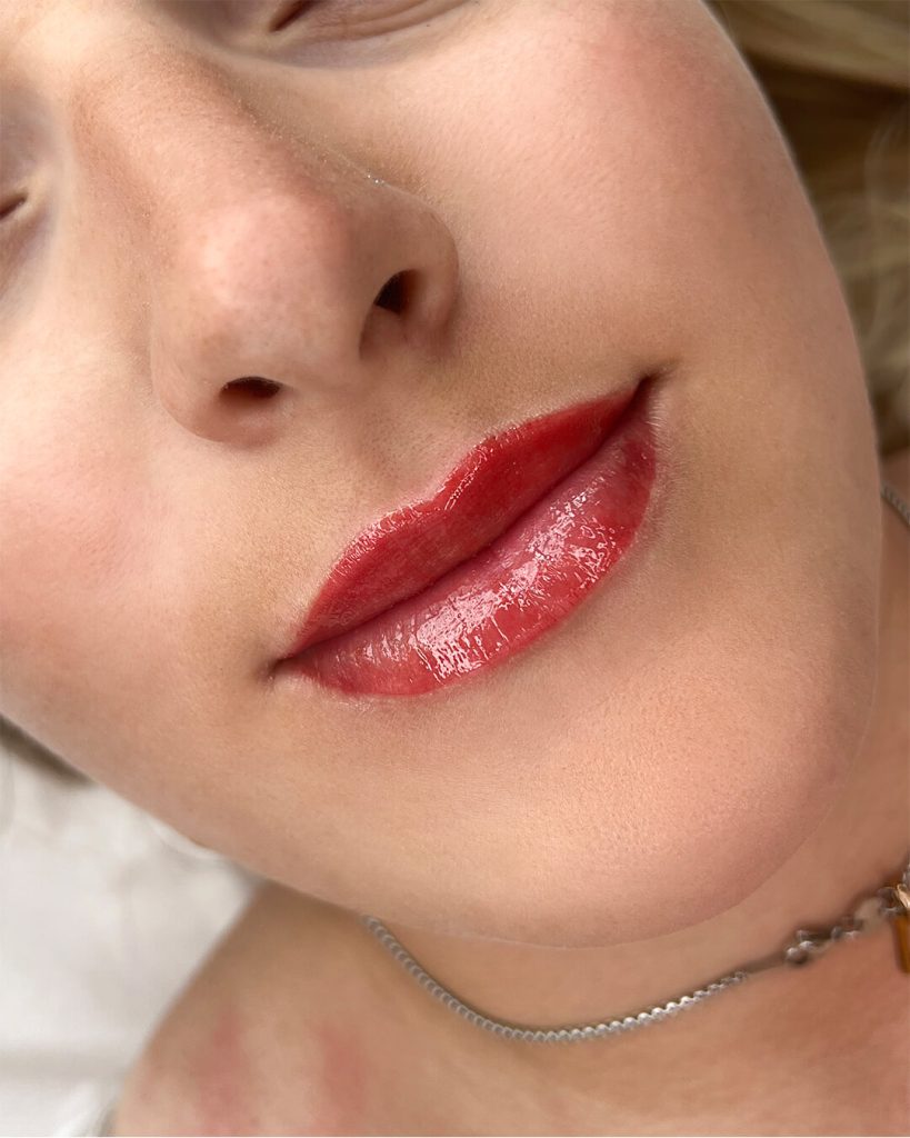 22-treatments_0003_lips-new